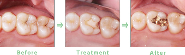 Before→Treatment→After