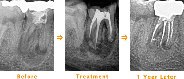 Before→Treatment→After