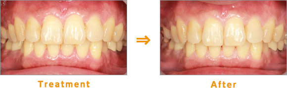 Treatment→After