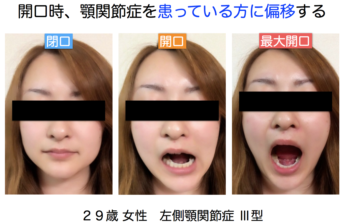 顎(がく)関節症の治療 枚方の歯医者【本多歯科】 顎(がく)関節症の治療 枚方の歯医者【本多歯科】